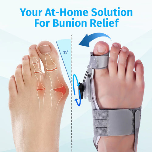 Vathera™ Bunion Fix